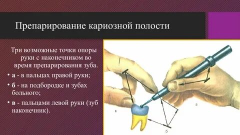 Препарировать это