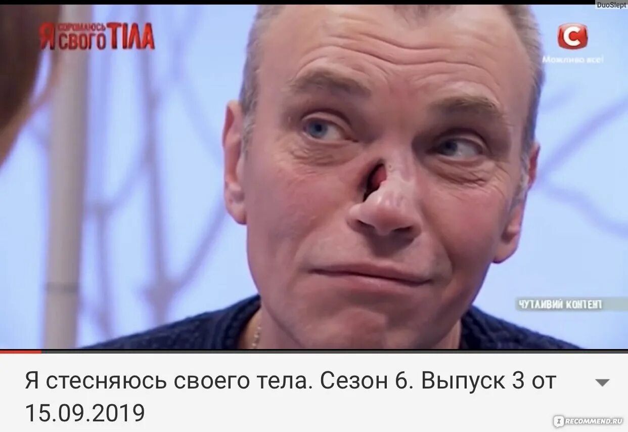 Программа я стесняюсь своего тела. Я не стесняюсь своего тела. герои программы я стесняюсь своего тела. я стесняюсь своего тела мужчина с носом.