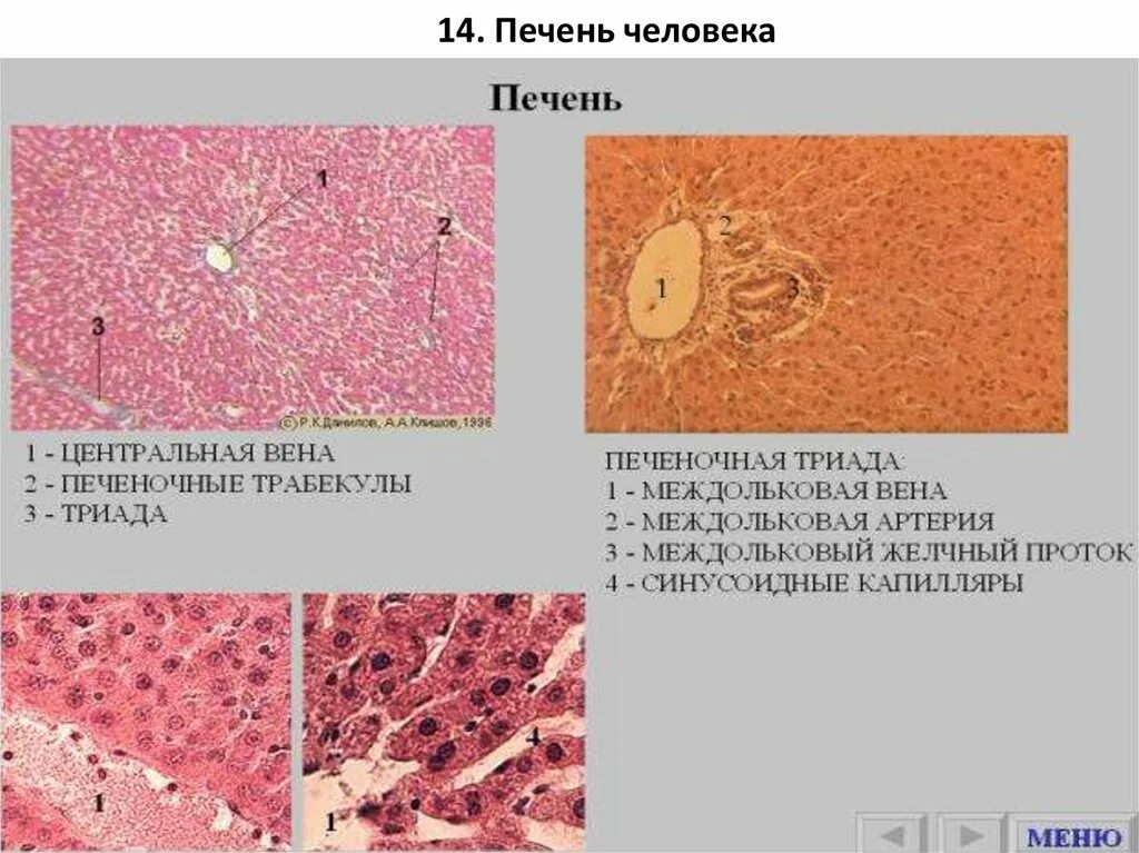 Печень микропрепарат описание. Строение паренхимы печени гистология. Печень гематоксилин эозин гистология. Печеночная балка гистология препарат. Печеночная Триада гистология препарат.