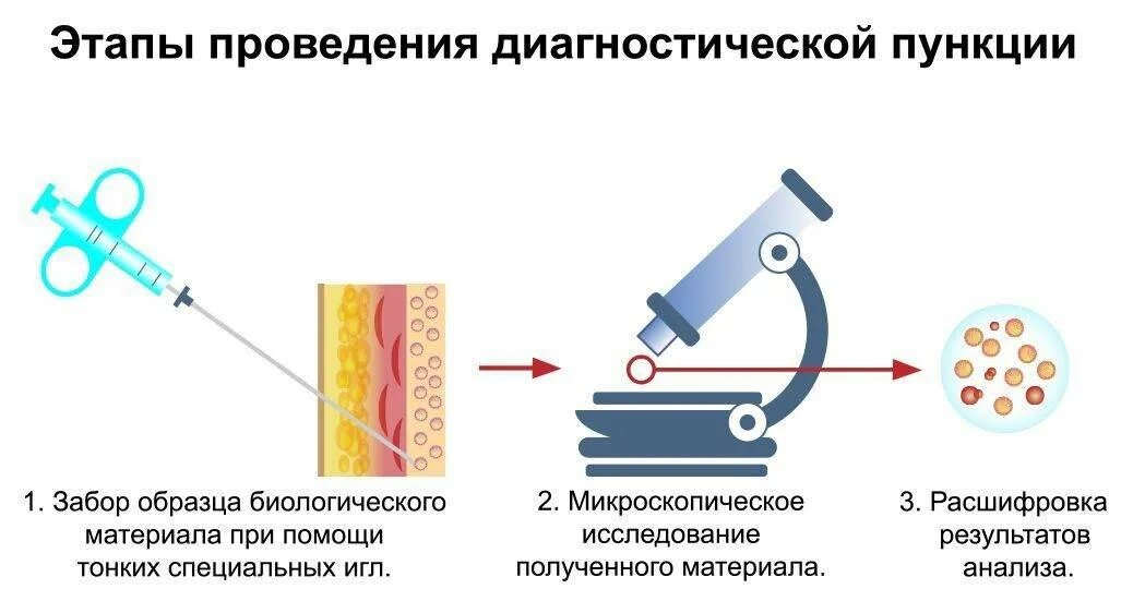 Пункция методика исследования. Пункция почки методика. Методика проведения стернальной пункции. Взятие материала для гистологического исследования. Стерильная пункция