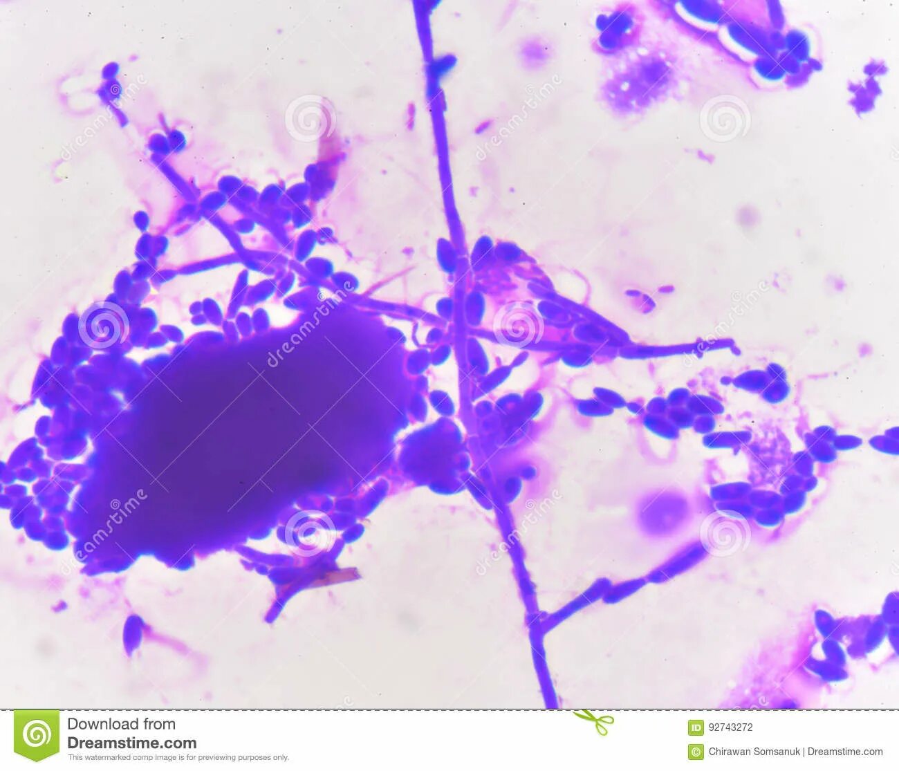 Споры candida. Candida дрожжевые клетки псевдомицелий. Грибы кандида микроскопия. Бластоспоры кандида. Дрожжеподобные грибы: псевдомицелий.