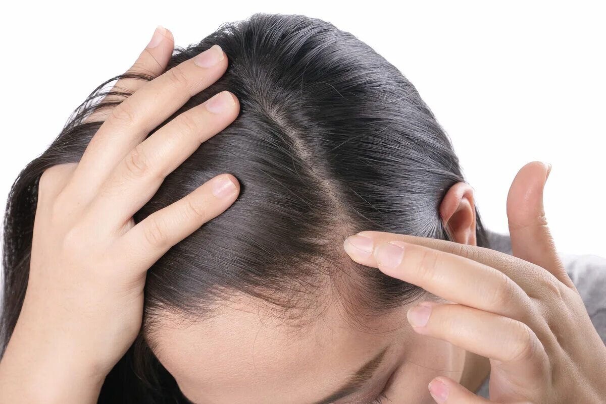 Head definition