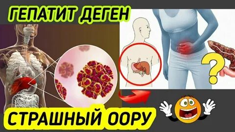 Сарык оорусу