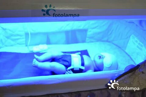 Лежать под лампой новорожденному