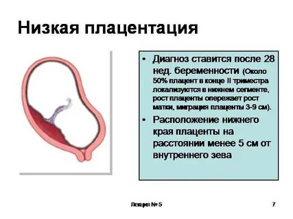 Беременность 12 недель низкая плацента