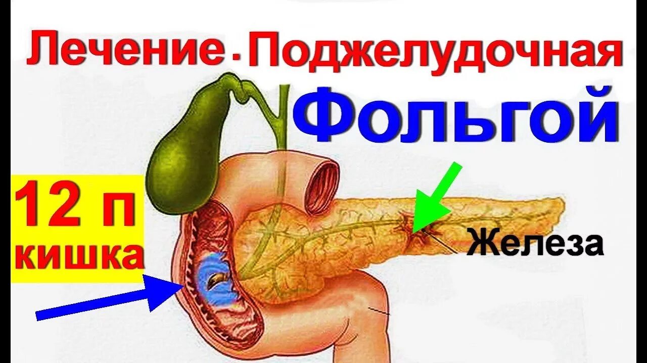 Лечение поджелудочной железы у мужчин в домашних. Как лечить поджелудочную. Лечится поджелудочная железа. Лекарство для поджелудочной железы. Терапия поджелудочной железы.