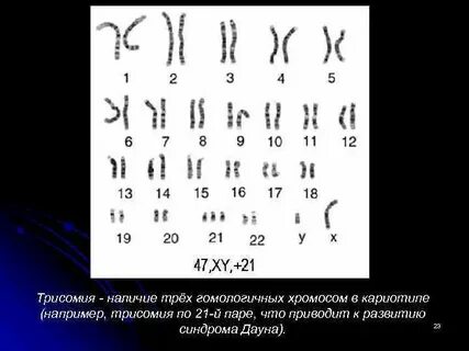 23 хромосомы