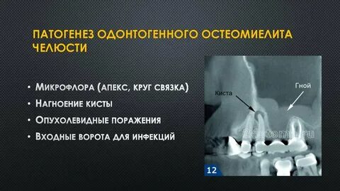 Остр верхних