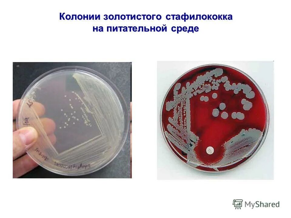 Staphylococcus aureus среда. Стафилококк золотистый Staphylococcus aureus. Золотистый стафилококк на ЖСА. Среды для стафилококков. Стафилококк на питательной среде.