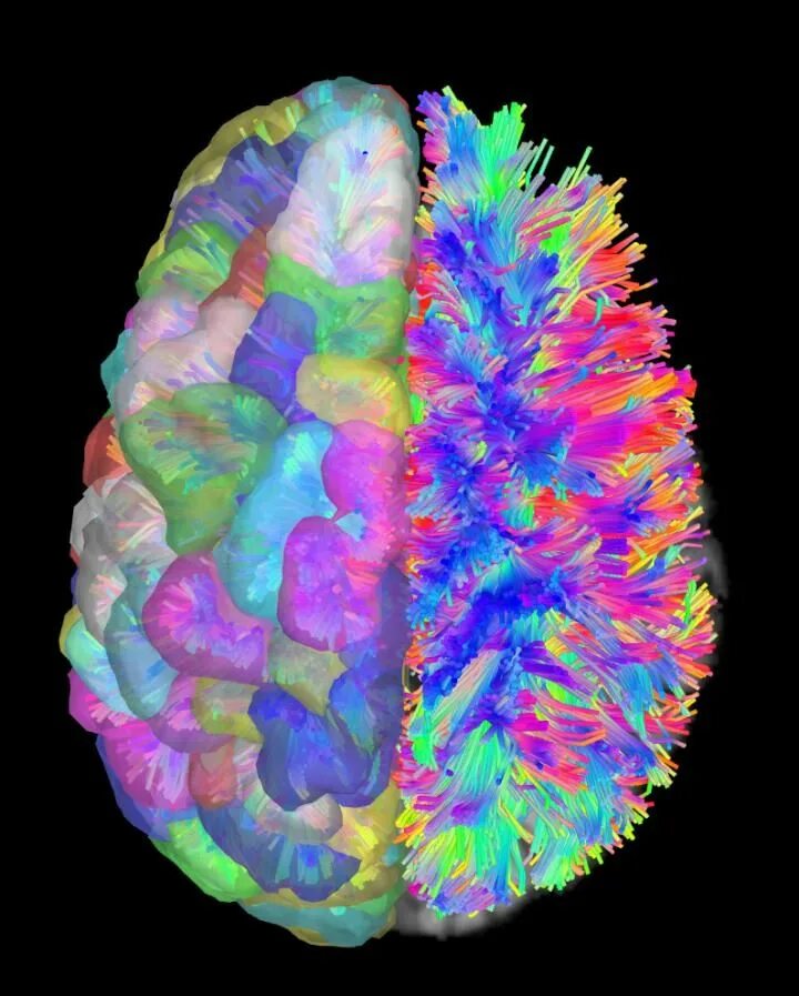 Нейробиология мозга. Brain Neural small. Brain in the most beautiful.