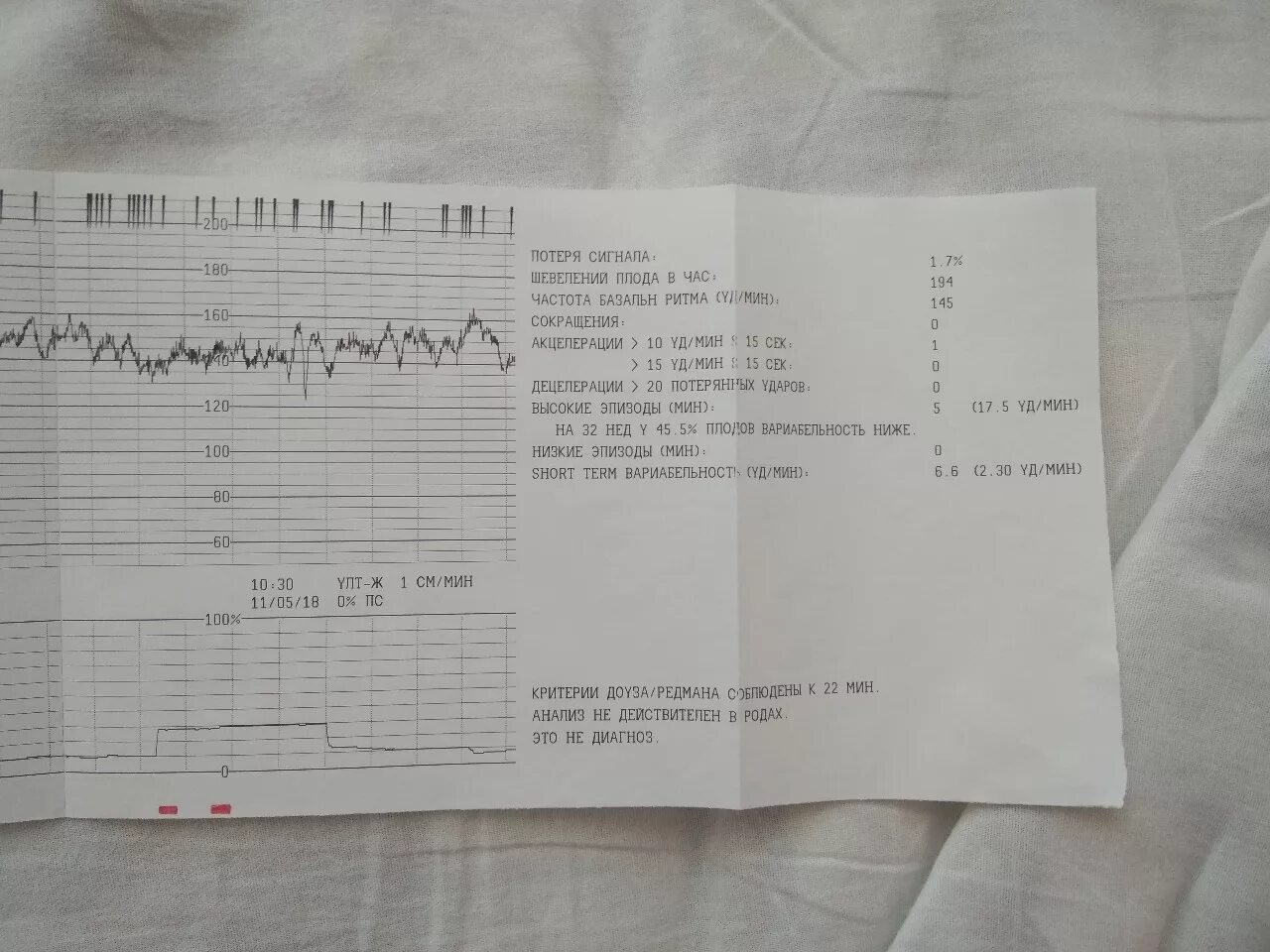 Что такое вариабельность на КТГ плода норма. Short term вариабельность КТГ норма. Вариабельность коротких интервалов КТГ норма. Вариабельность сердечного ритма плода на КТГ. 19 недель нет шевелений