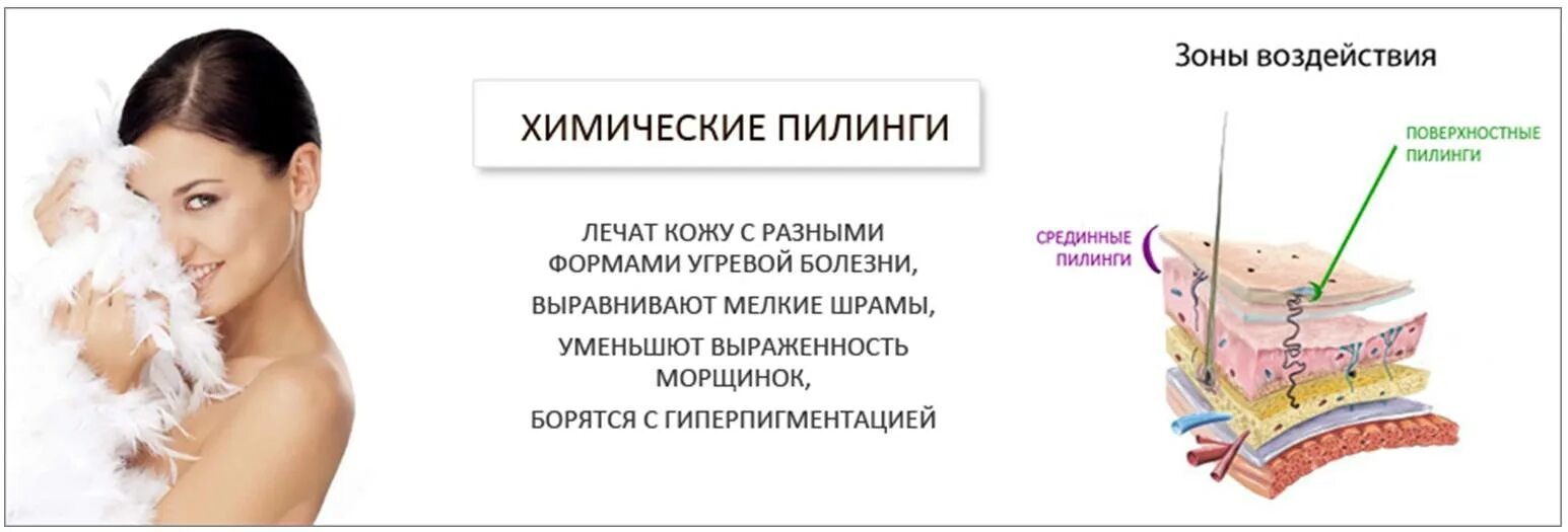 Пилинг лица польза и вред. Химические пилинги. Химические пилинги для лица. Химические пилинги в косметологии. Химические пилинги для лица в косметологии.