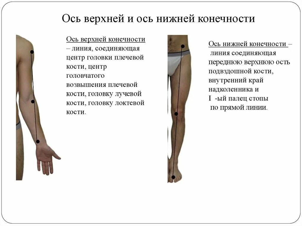 Изм оси. Ось верхней и нижней конечности. Нарушение оси нижней конечности. Ось верхней конечности. Длина оси конечностей.