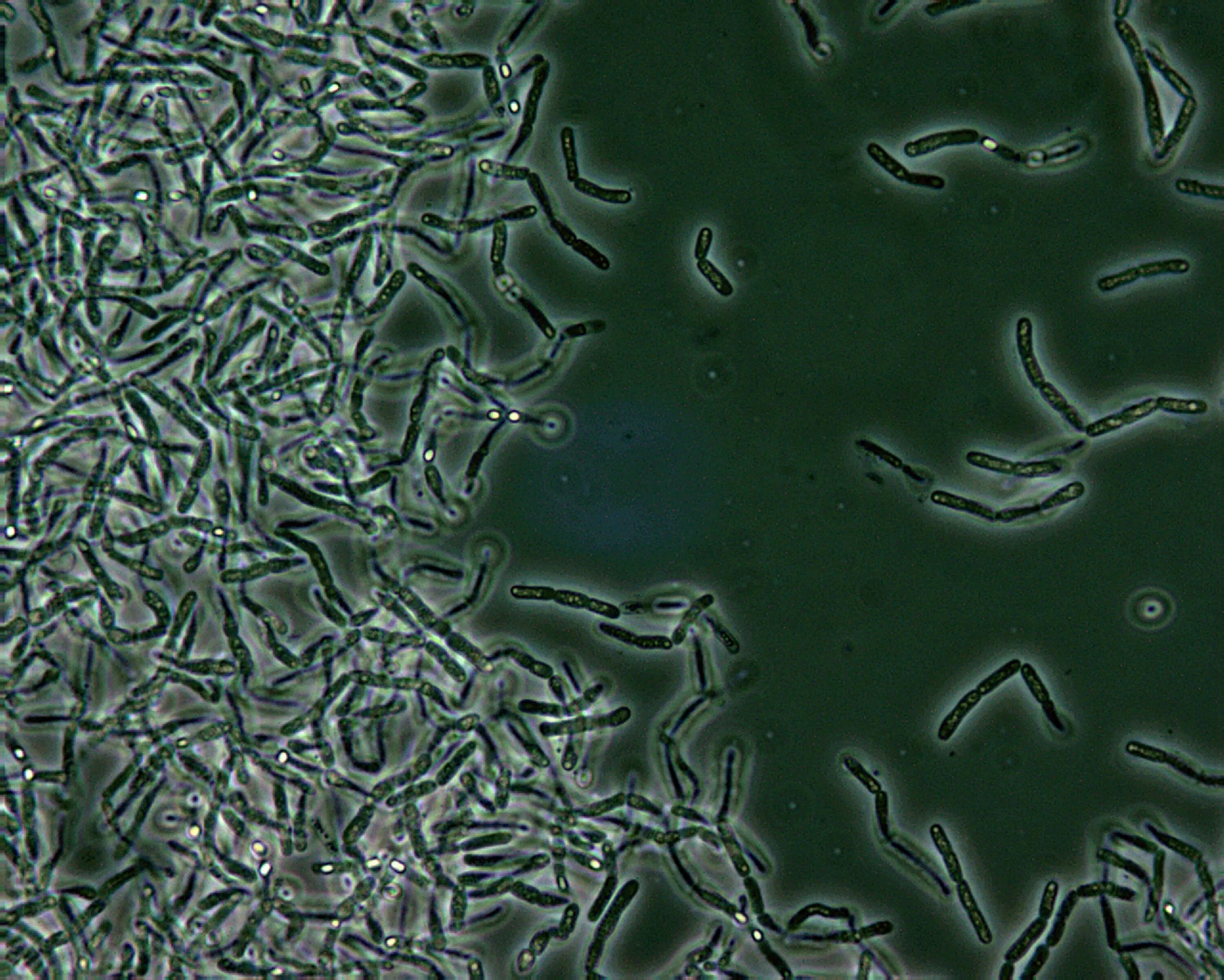 Bacillus anthracis микроскопия. Бациллы сибирской язвы микроскопия. Bacillus anthracis Сибирская язва. Клетка язвы