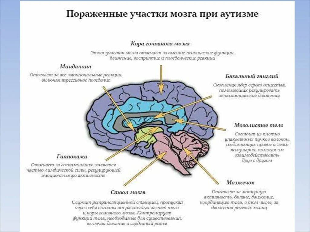 Органические изменения головного мозга. Поражение зон мозга при ДЦП. Мозг аутиста. Мозг при аутизме. Головной мозг при аутизме.