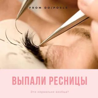 Выпала ресничка