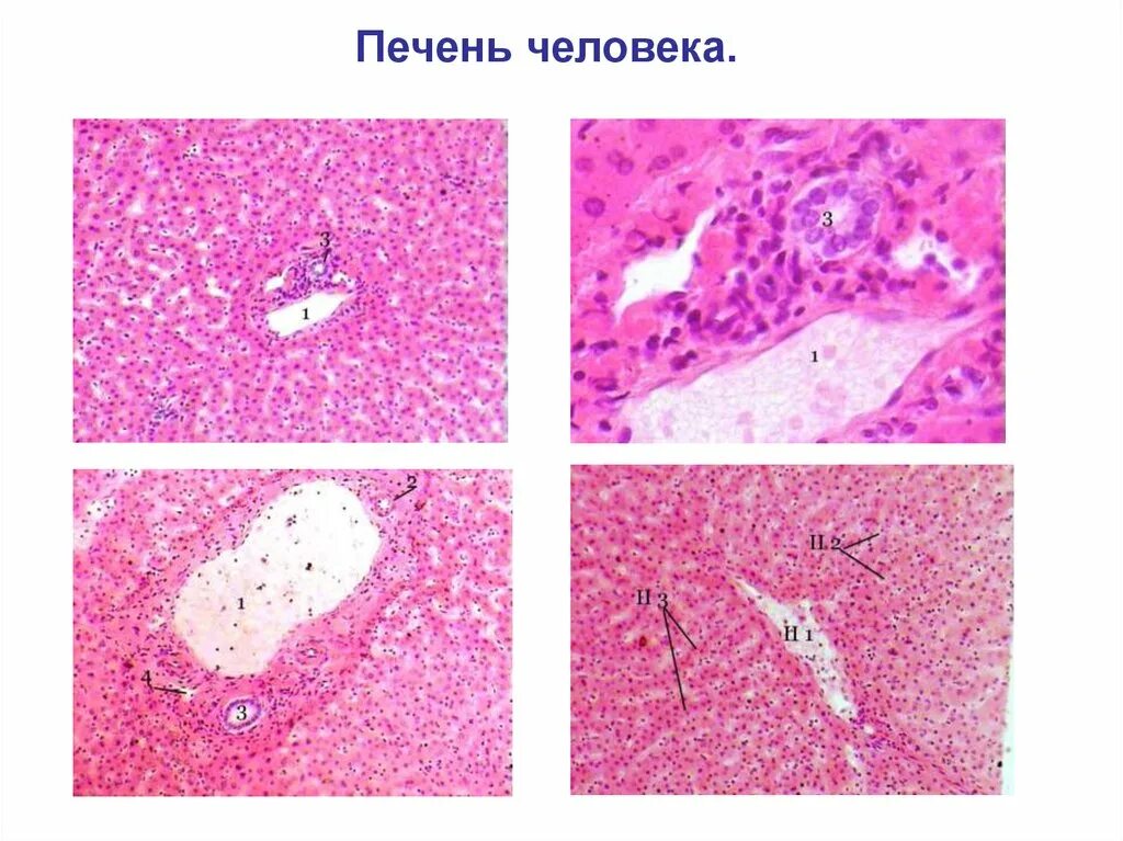 Препарат железа печень