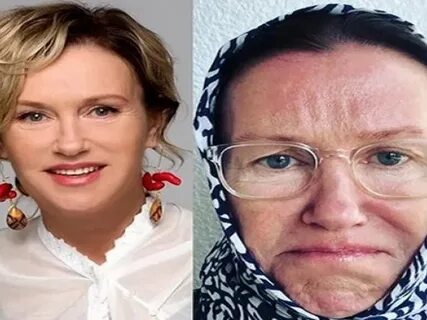 Ирина розанова до и после пластики Mathplat.ru