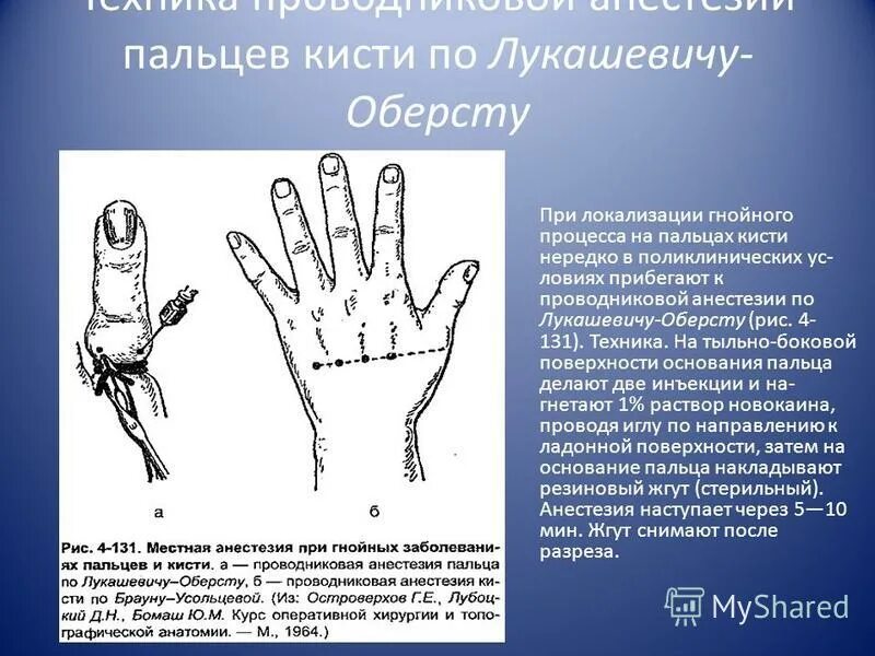 Обезболивающее средство при переломе. Анальгетики при переломах. Обезболивающие препараты при ушибах. Обезболивание при переломах. Местная анестезия перелома.
