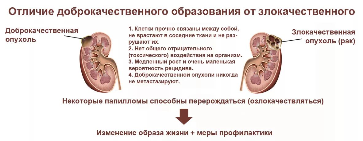 Доброкачественная опухоль. Доброкачественная опухоль и злокачественная опухоль. Доброкачественные и злокачественные новообразования. Злокачественная опухоль и доброкачественная отличие. Злокачественный характер