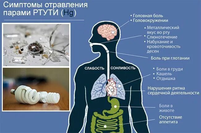 Меркуриализм