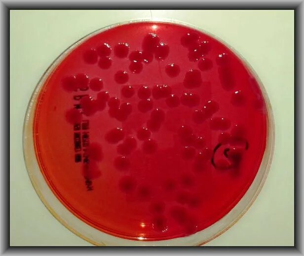 Эшерихии на Эндо. Сальмонелла на Эндо. Кишечная палочка Escherichia coli. Эшерихия кишечная палочка. Среда для кишечной палочки