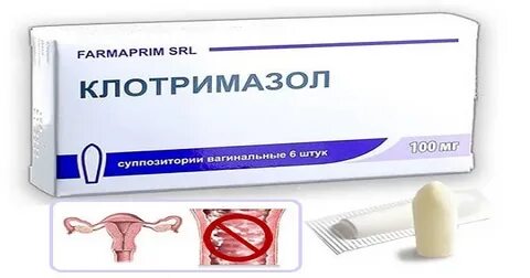 Клотримазол в гинекологии