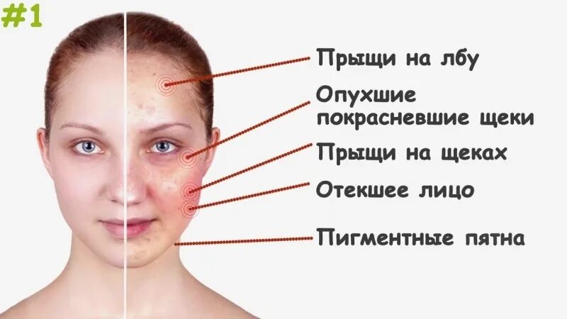 Почему прыщи на лбу у женщин. Почему прыщи на лбу у женщин