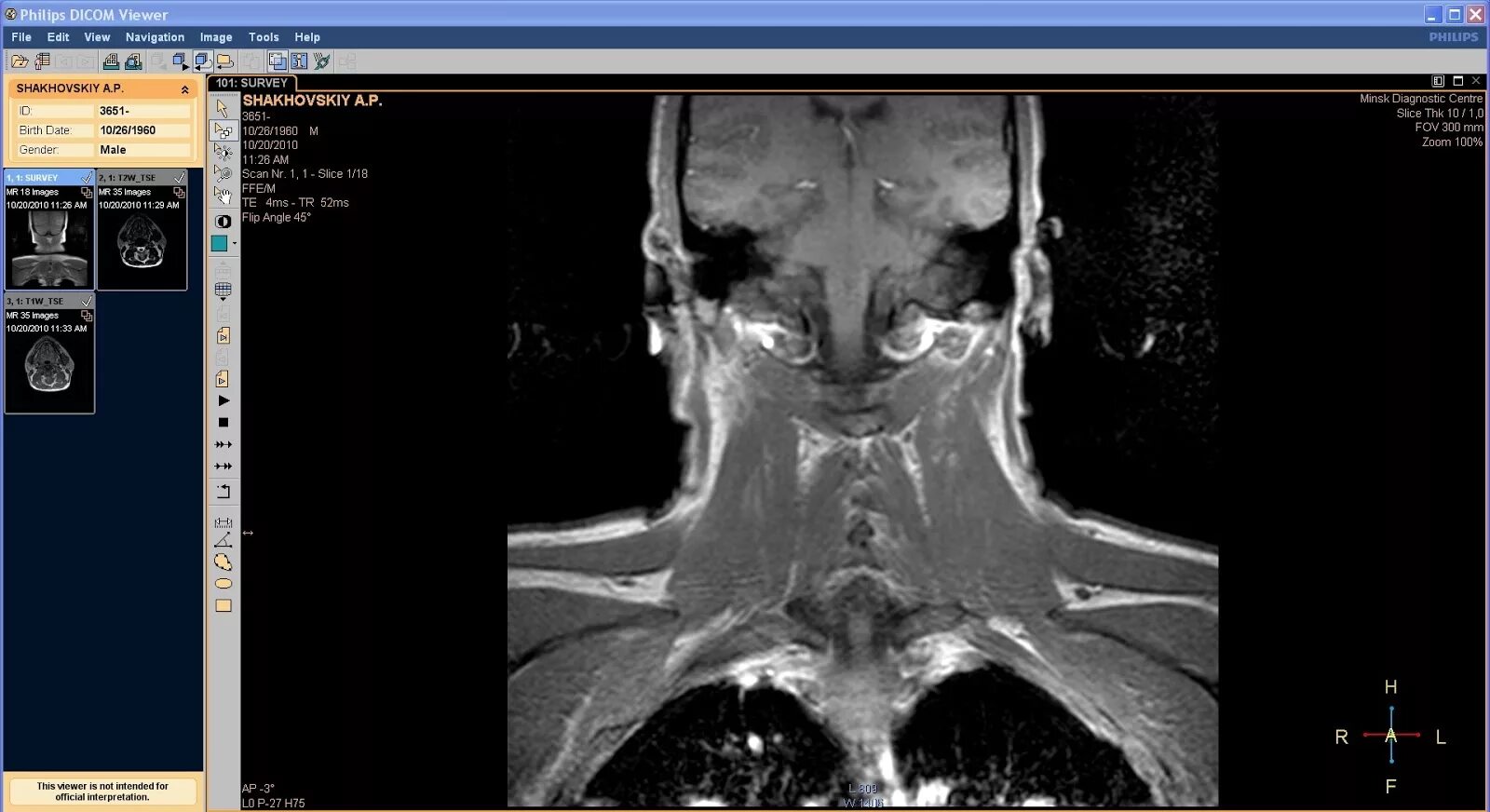 Dicom viewer. Мрт dicom. dicom 3.0. philips dicom viewer. программа для просмотра кт снимков.