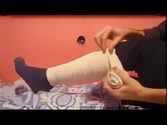 Почему повязка на ноге горин вопросы. Гипс полификс. солевая повязка на спину. массаж кистей. солевая повязка при тромбофлебите.