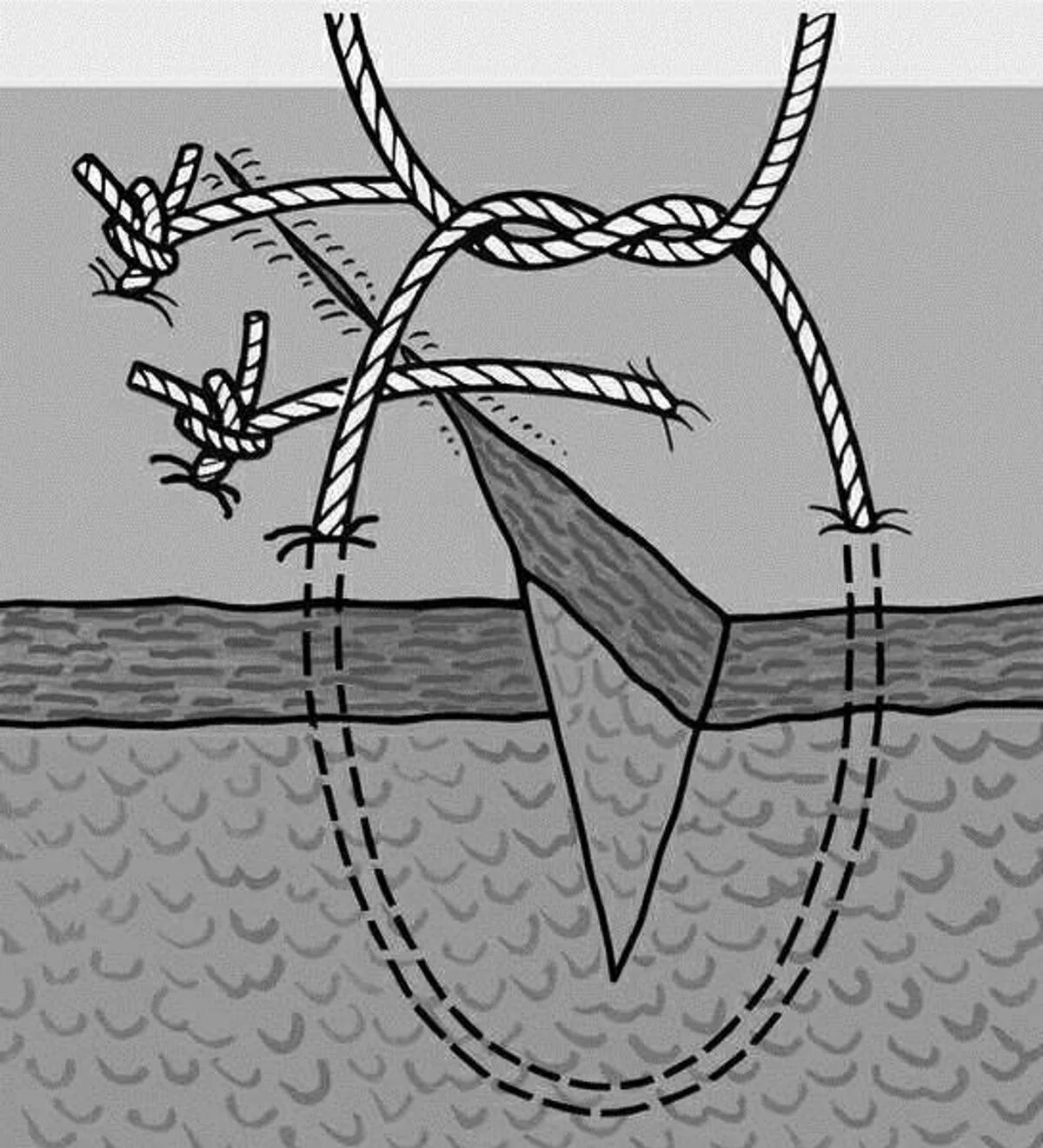 Техника наложения хирургических швов. Узловатый хирургический шов. Простой Узловой шов хирургия. Техника наложения узловатого шва.