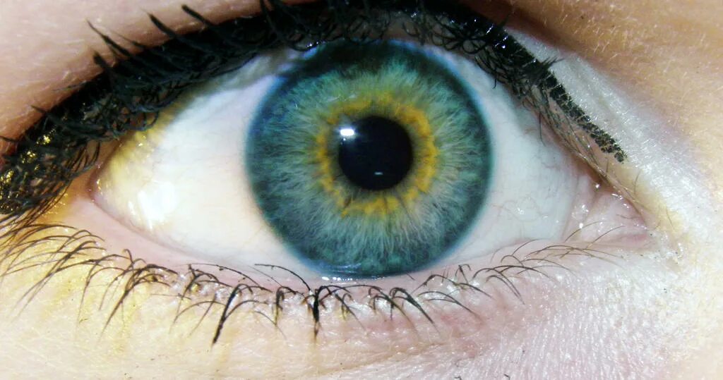 Зелено голубо желтые глаза. Центральная гетерохромия голубых глаз. Центральная гетерохромия глаз Карий и зеленый. Центральная гетерохромия серый и зеленый. Центральная гетерохромия карих глаз.