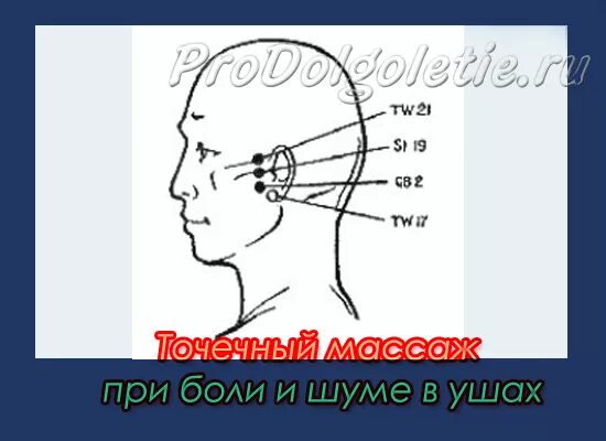 Козелковый массаж уха. Точки иглоукалывания при головной боли. Акупунктурные точки при шуме в ушах и голове. Точки для массажа при шуме в ушах. Акупунктурные точки от шума в ушах.