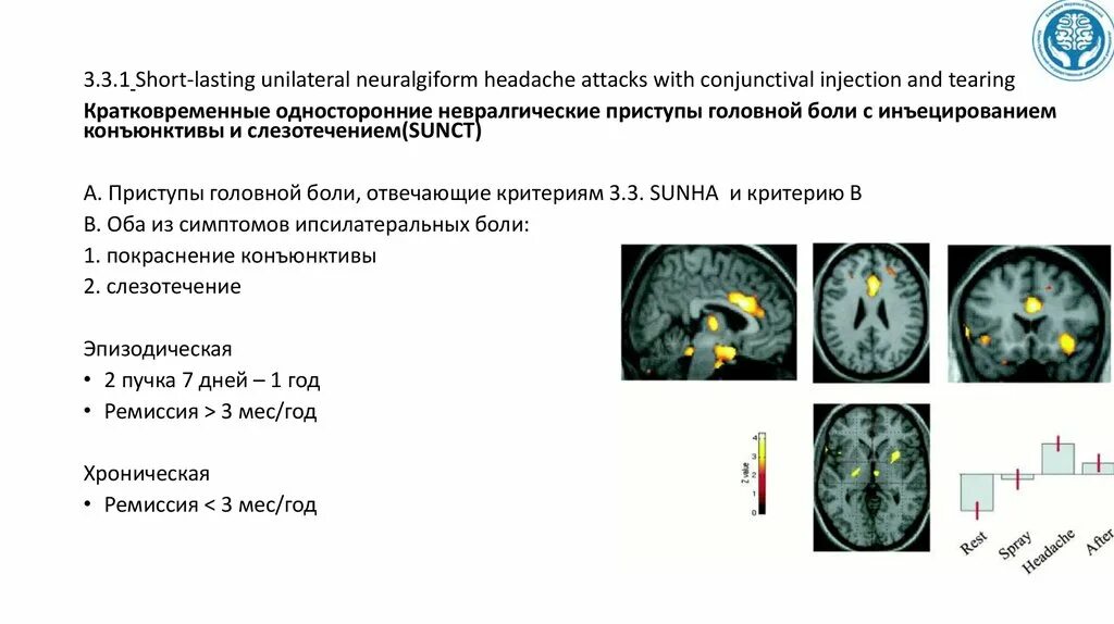 Цефалгия что. Цефалгия головного. Тригеминальные вегетативные цефалгии. SUNCT синдром лечение. Симптомы цефалгии.