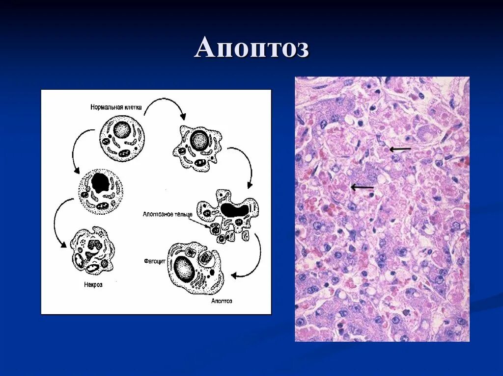 Апоптоз препарат патологическая анатомия. Апоптоз клетки микроскоп. Апоптоз препарат патанат. Апоптоз клеток это