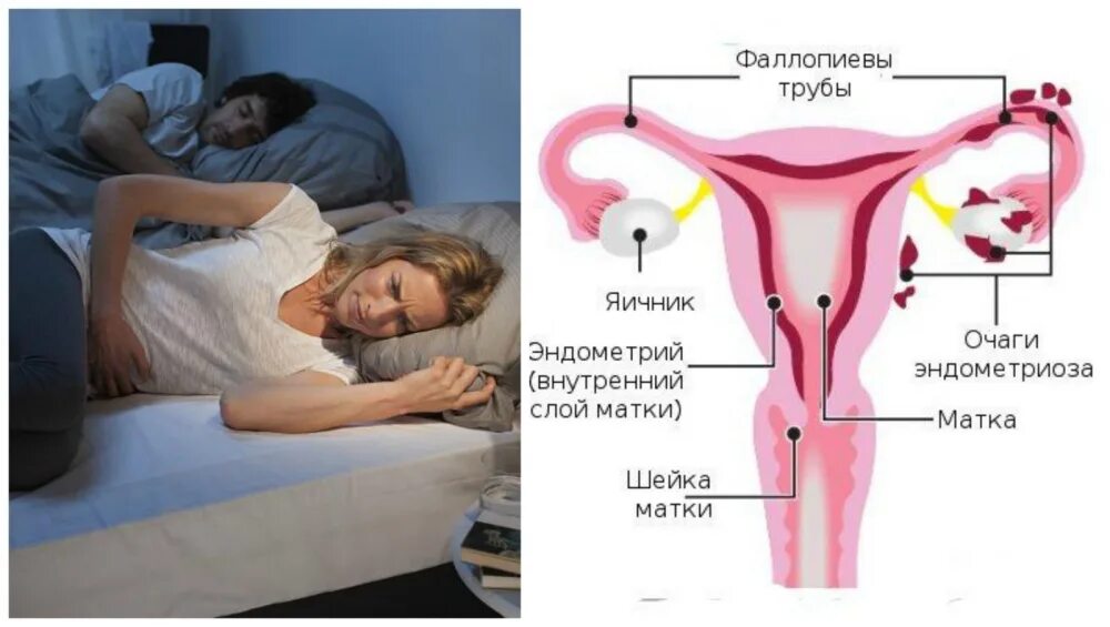 Менопауза матка