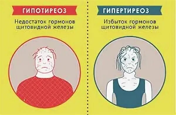 Манифестный гипотиреоз