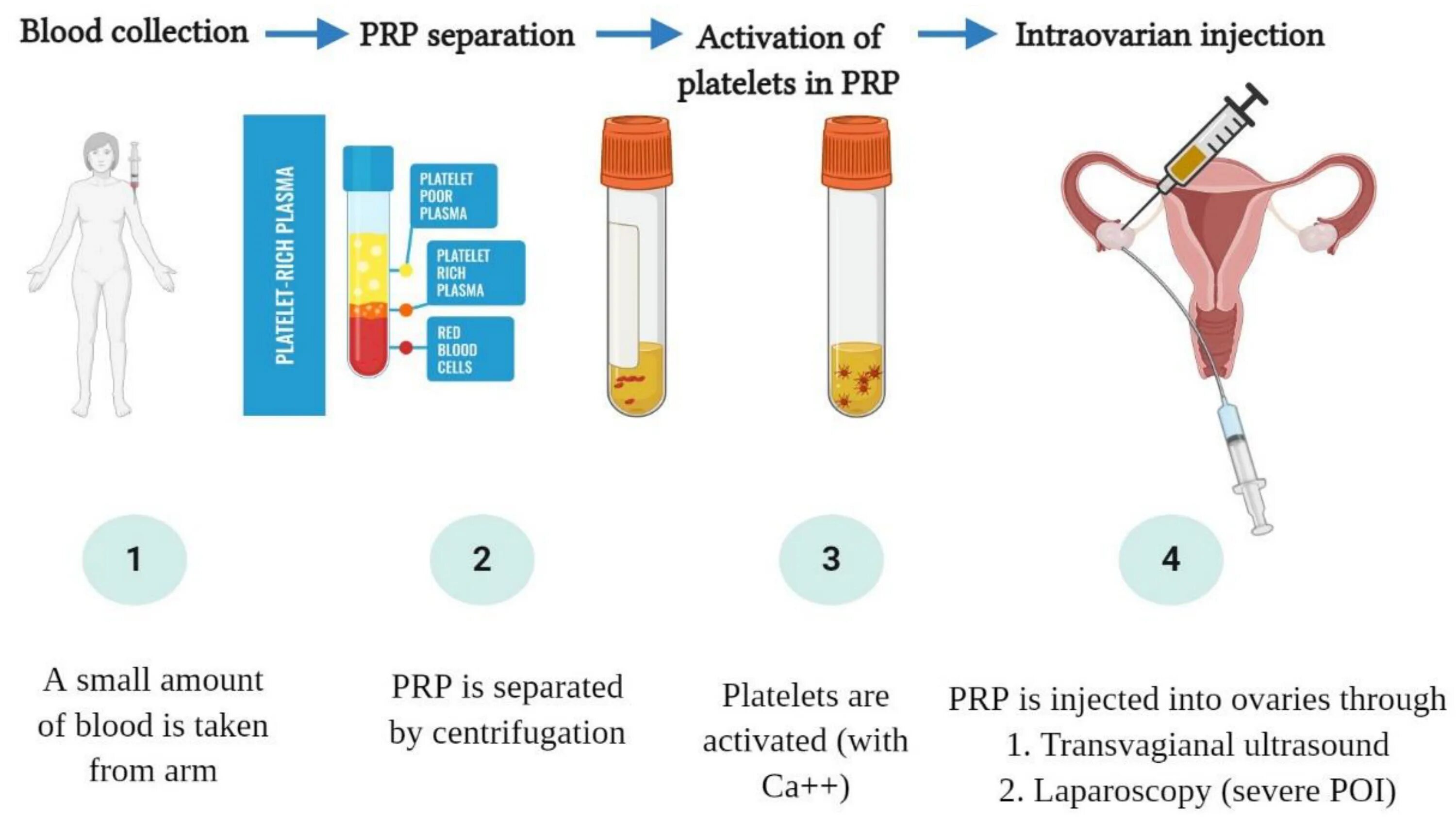 PRP Platelet Rich Plasma. Датчик PRP G PRP b12. PRP терапия в гинекологии. Prp эндометрия