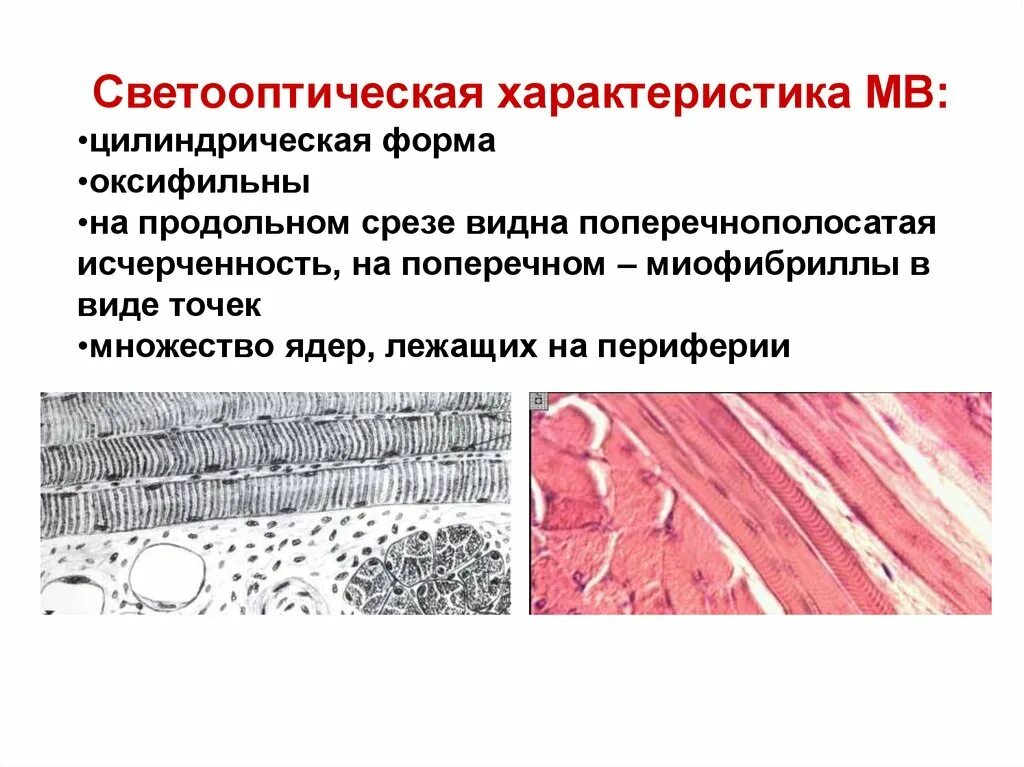 Какова особенность волокон поперечнополосатой мышечной ткани. Поперечнополосатая исчерченность. Поперечно-полосатая исчерченность мышечного волокна обусловлена. Поперечнополосатая мышечная ткань. Поперечно исчерченная мышечная ткань.