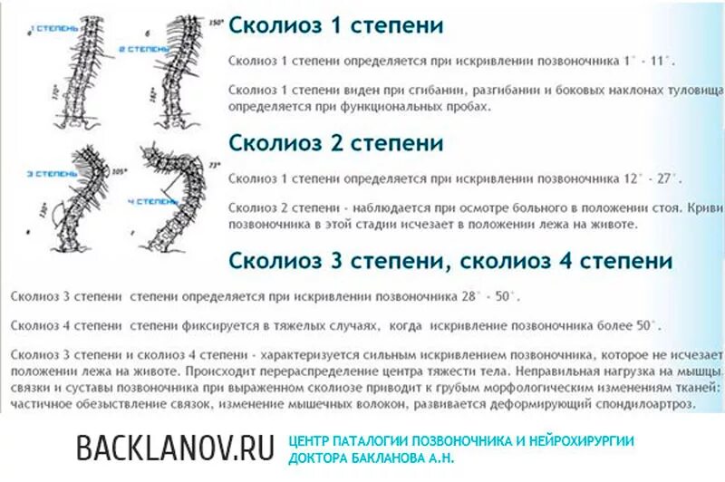 Локальный статус позвоночник. Сколиоз 2 степени угол искривления. S образное искривление позвоночника 3 степени. S образный грудопоясничный сколиоз 1 степени. Е образный грудопоясничный сколиоз 2 степени.