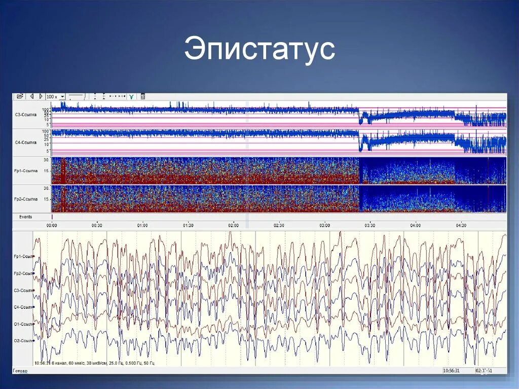 Эпи кю эпи бе. Эпистатус. эпи на ээг. ээг мониторинг у животных. ээг головного мозга животных.