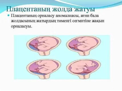 Бруна Butterfly порно