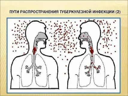 Распространение воздушно капельных инфекций