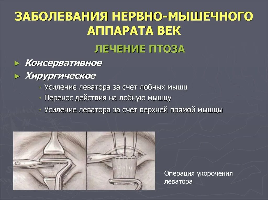 Нервно мышечные патологии. Заболевания нервно мышечного аппарата. Патология нервно мышечного аппарата век. Лекция нервно мышечные заболевания. Заболевание нейромышечного аппарата.