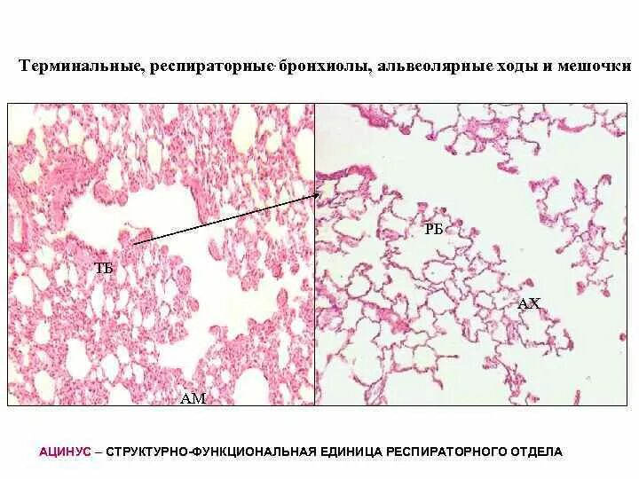 Терминальные бронхиолы