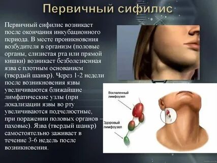 После полового контакта больно
