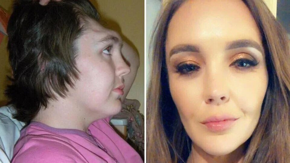 слава мэрлоу лысина. неровный лоб у девушки. впалые круги под глазами. слава марлоу побрился налысо. вмятины после на лице.