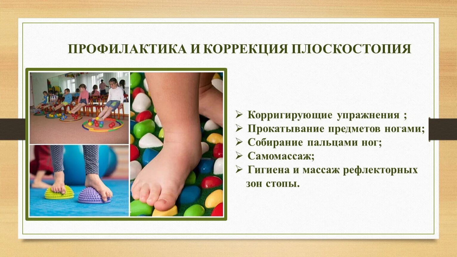 Меры предосторожности плоскостопия. Гимнастика для профилактики плоскостопия у детей. Методы профилактики плоскостопия. Профилактика нарушения плоскостопия. Профилактика плоскостопия у детей.