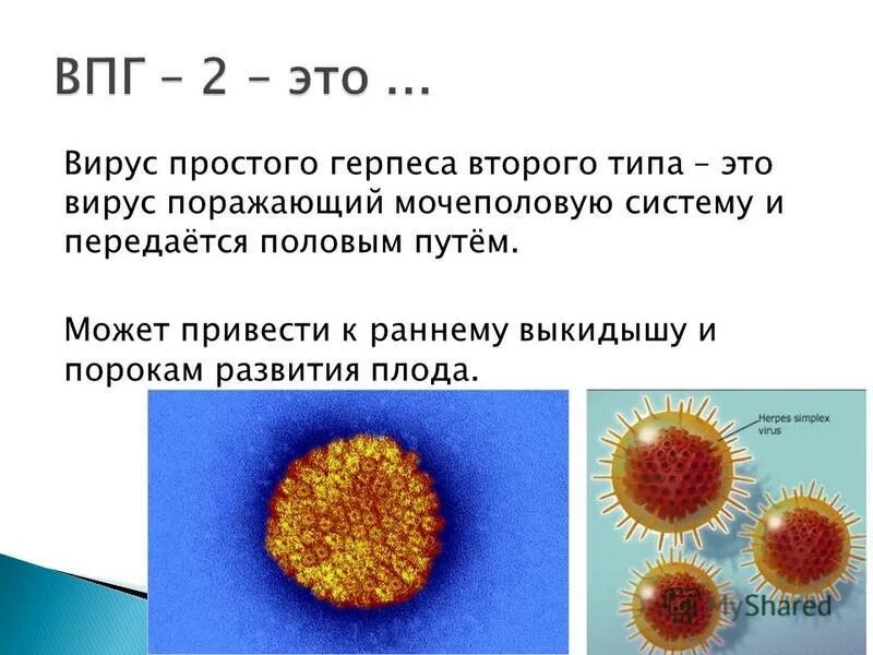 Вирус герпеса 2. Вирус простого герпеса типы. Вирус простого герпеса ВПГ 2.
