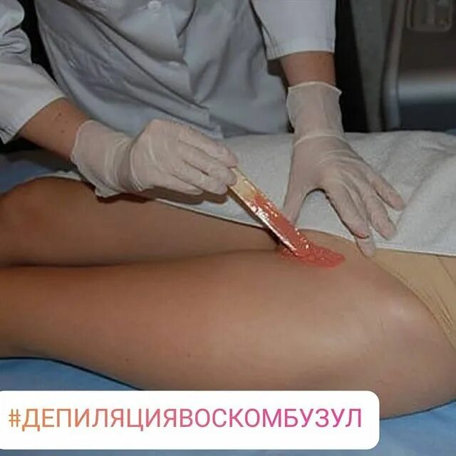 Ваксинг зоны глубокого бикини. Бразильский ваксинг. Депиляция бикини воском схема. Шугаринг глубокое бикини. Депиляция воском глубокое бикини.